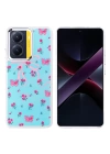 Xiaomi Poco X7 Pro Kılıf Airbag Tasarımlı Zore Hadra Kapak