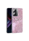 Xiaomi Poco X7 Pro Kılıf Kamera Korumalı Figürlü Zore Ponti Silikon Kapak