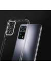 Xiaomi Redmi Note 11 Global Kılıf Zore Kamera Korumalı Nitro Anti Shock Silikon
