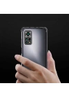 Xiaomi Redmi Note 11 Global Kılıf Zore Kamera Korumalı Nitro Anti Shock Silikon