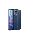 Xiaomi Redmi Note 11 Global Kılıf Zore Niss Silikon Kapak