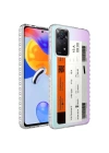 Xiaomi Redmi Note 11 Pro 5G Kılıf Airbag Kenarlı Renkli Desenli Silikon Zore Elegans Kapak