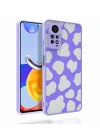 Xiaomi Redmi Note 11 Pro 5G Kılıf Desenli Kamera Korumalı Parlak Zore Nora Kapak