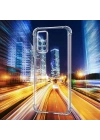 Xiaomi Redmi Note 11S Global Kılıf Zore Kamera Korumalı Nitro Anti Shock Silikon