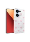 Xiaomi Redmi Note 13 Pro 4G Kılıf Kamera Korumalı Desenli Zore Klip Kapak