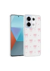 Xiaomi Redmi Note 13 Pro 5G Kılıf Kamera Korumalı Desenli Zore Klip Kapak