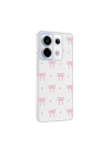 Xiaomi Redmi Note 13 Pro 5G Kılıf Kamera Korumalı Desenli Zore Klip Kapak
