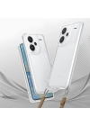 Xiaomi Redmi Note 13 Pro Plus 5G Kılıf Airbagli Takılabilir Askı Aparatlı Zore Snap Silikon Kapak