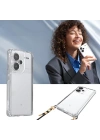 Xiaomi Redmi Note 13 Pro Plus 5G Kılıf Airbagli Takılabilir Askı Aparatlı Zore Snap Silikon Kapak