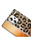 Xiaomi Redmi Note 13 Pro Plus 5G Kılıf Desenli Zore Mep Kapak
