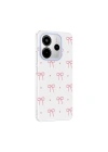 Xiaomi Redmi Note 14 4G Kılıf Kamera Korumalı Desenli Zore Klip Kapak