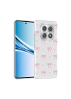 Xiaomi Redmi Note 15 5G Kılıf Kamera Korumalı Desenli Zore Klip Kapak