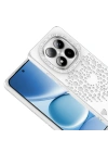 Xiaomi Redmi Note 15 Pro 4G Kılıf Damla Taşlı Zore Rivas Sert PC Kapak
