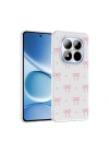 Xiaomi Redmi Note 15 Pro Plus Kılıf Kamera Korumalı Desenli Zore Klip Kapak