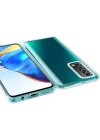 More TR Huawei P Smart 2021 Kılıf Zore Enjoy Kapak