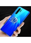 Huawei P30 Pro Kılıf Zore Mill Silikon