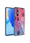 More TR Huawei Nova 9 SE Kılıf Kamera Korumalı Desenli Sert Silikon Zore Epoksi Kapak