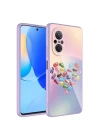 More TR Huawei Nova 9 SE Kılıf Kamera Korumalı Desenli Sert Silikon Zore Epoksi Kapak