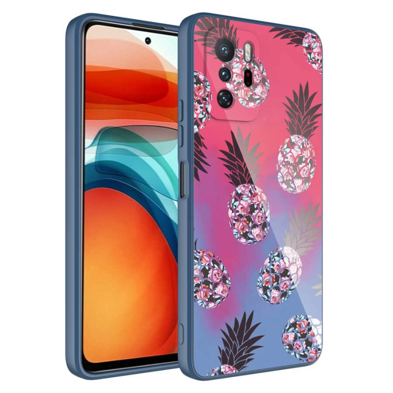 More TR Xiaomi Redmi Note 10 Pro Kılıf Kamera Korumalı Desenli Sert Silikon Zore Epoksi Kapak