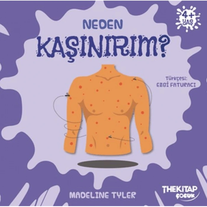 Neden Kaşınırım?