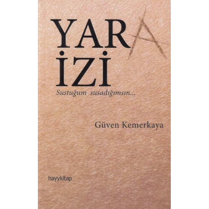 Yara İzi