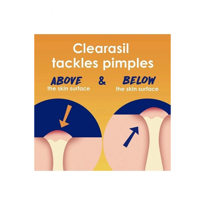 Stubborn Acne Control Maximum Strength Cream 28 Gr.