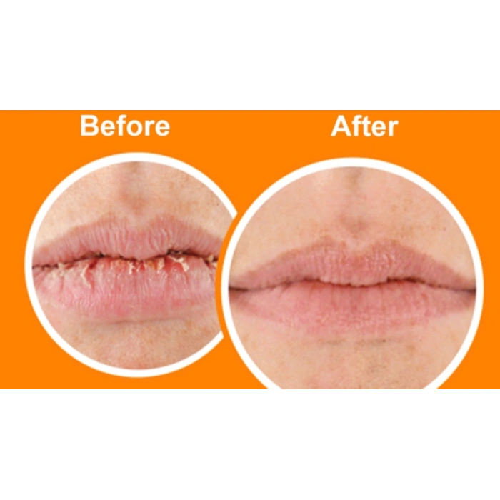 OKeeffes Lıp Repaır Lip Balm Uncedted  Lip Balm 4.2 g