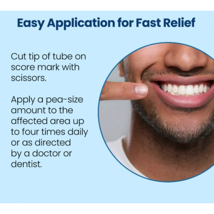 Anbesol Diş ve Diş Rahatlatıcı Jel 9 gr