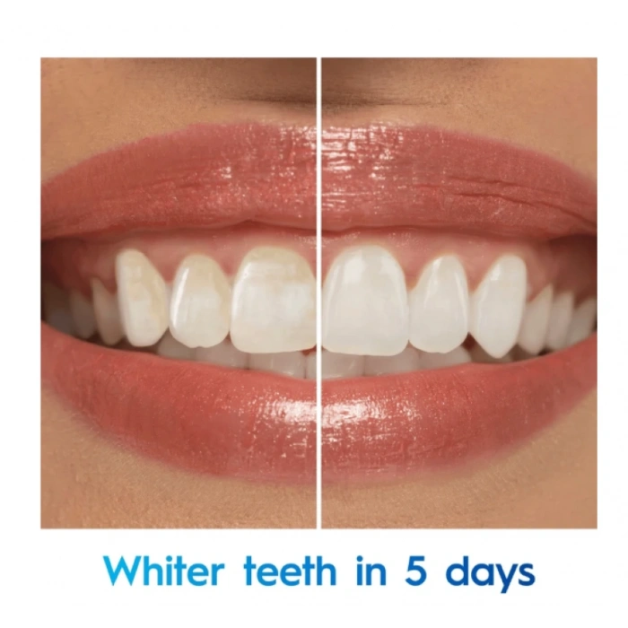 Crest 3D Whıte Advanced Glamorous Whıte whıt Staın-Blastıng Foam Whiter Teeth in 5 Days  93g x 2 Adet Diş Macunu
