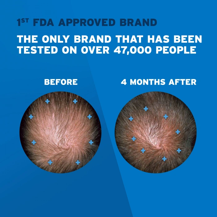 Ekstra Güçlü Saç Bakım Solisyonu Topical Hair Regrowth Treatment Reactıvates 3 lü Set