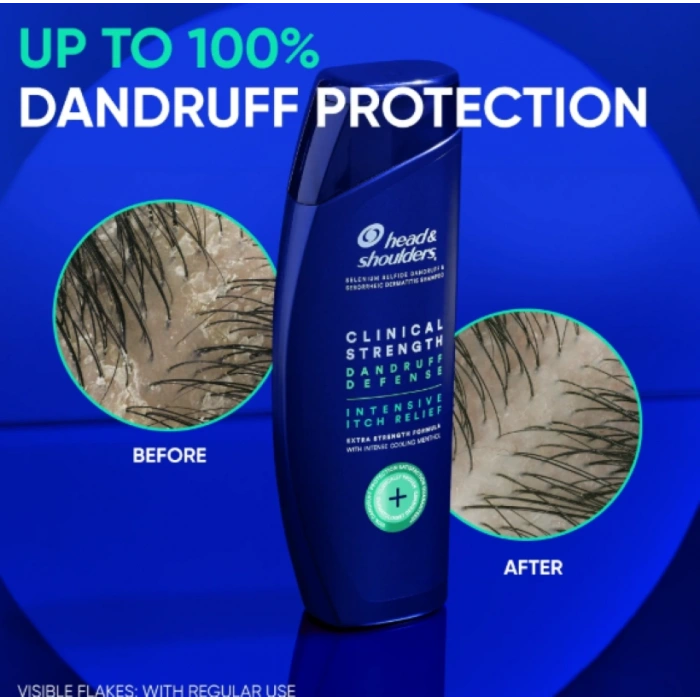 Head & Shoulders 2 ın 1 Clınıcal Strenght Dandruff Defense Intensıve Itch Relıef Şampuan 400 ml
