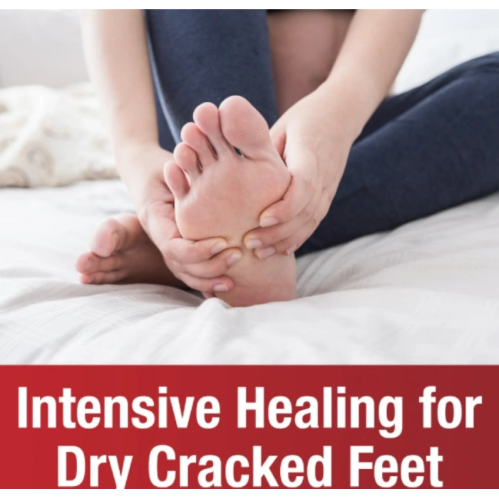 Kerasal See A Vısıble Dıfference Intensive Foot Repair Çatlak Topuklar ve Kuru Ayaklar İçin Cilt İyileştirici Krem 30g