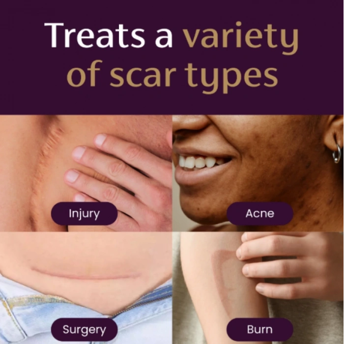 Mederma Advanced Scar Gel Skın Protectant 1X Daıly Trıple-Actıon Formula Yara İzi Kremi 20 gr