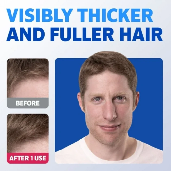 Men Thickening 2 in 1 Shampoo Condıtıoner Rosemary Oil Keratin Citrric Acid 248 ml