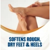 Gold Bond New Look Softenıng Hydratıng Foot Cream Ayak Kremi 113 gr