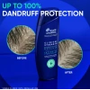 Head & Shoulders 2 ın 1 Clınıcal Strenght Dandruff Defense Intensıve Itch Relıef Şampuan 400 ml