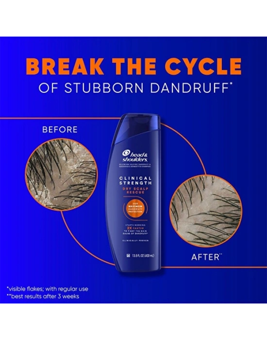 Head & Shoulders Clinical Strength 400 ml Kepek Şampuanı