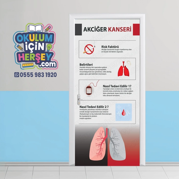 Akciğer Kanseri Kapı Giydirme 16