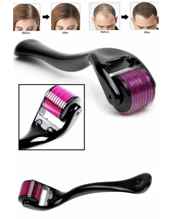 Derma Roller Titanyum Uçlu 540 İğneli 1 Mm Saç Sakal Çıkarma Ve Cilt Bakım Masaj Aleti