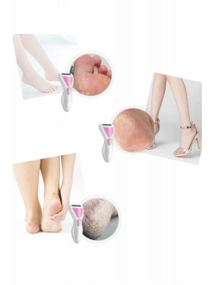 Epilatör Cihazı Epilasyon Aleti Çoklu Başlık Seçeneği Ayak Törpüsü