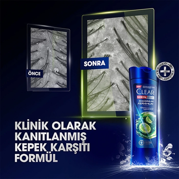 Clear Men Kepeğe Karşı Etkili Şampuan Maksimum Ferahlık Yağlı Saç Derisi İçin Limon Özlü 350 ml