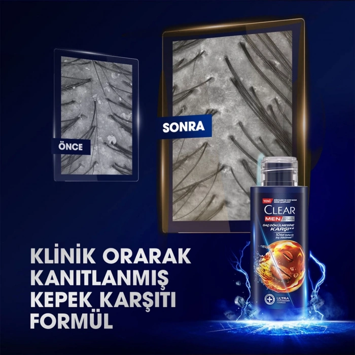 Clear Men Saç Dökülmelerine Karşı Seyahat Boy Şampuan 90 ml