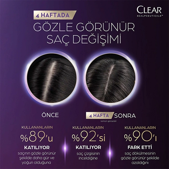 Clear Scalpceuticals Saç Bakım Şampuanı Saç Dökülmesine Karşı 300 ml