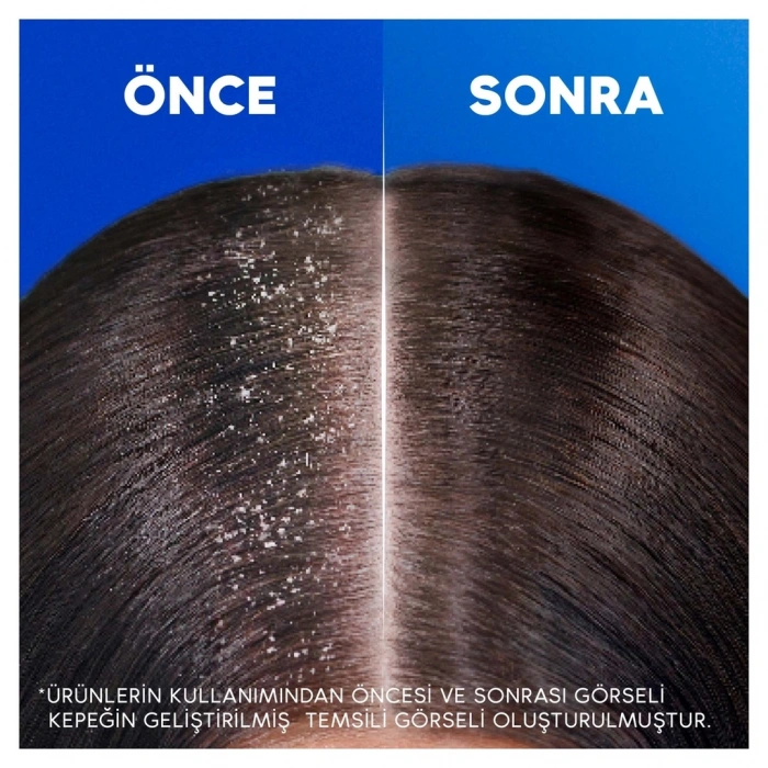 Head & Shoulders 2si 1 Arada İpeksi Yumuşaklık Kepek Karşıtı Şampuan 300 ml