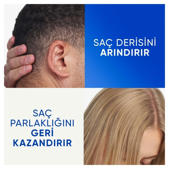 Head & Shoulders Arındırma ve Parlaklık Elma Sirkeli Şampuan 800 ml
