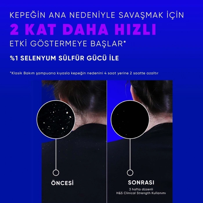 Head & Shoulders Clinical Strength Advanced Oil Control Yağ Dengeleyici Şampuan 400 ml