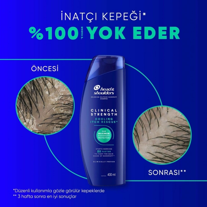 Head & Shoulders Clinical Strength Cooling Itch Rescue Kaşıntı Karşıtı Şampuan 400 ml