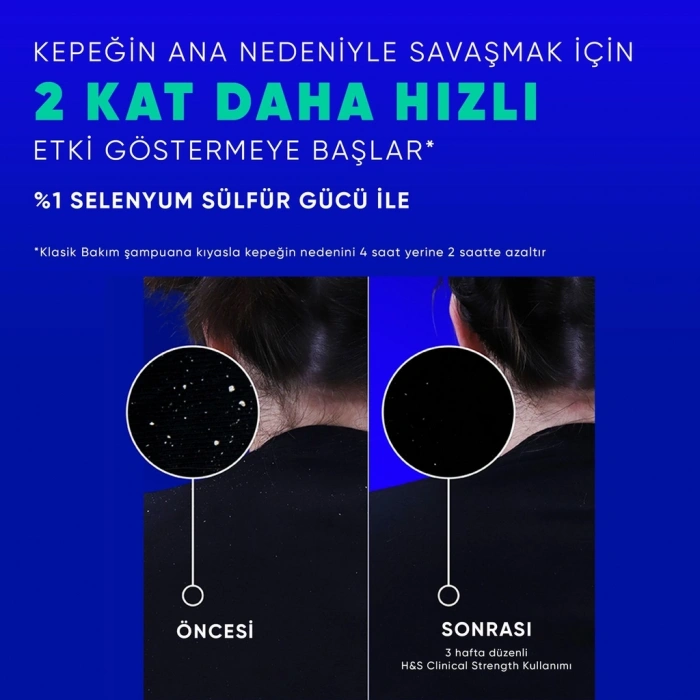 Head & Shoulders Clinical Strength Cooling Itch Rescue Kaşıntı Karşıtı Şampuan 400 ml