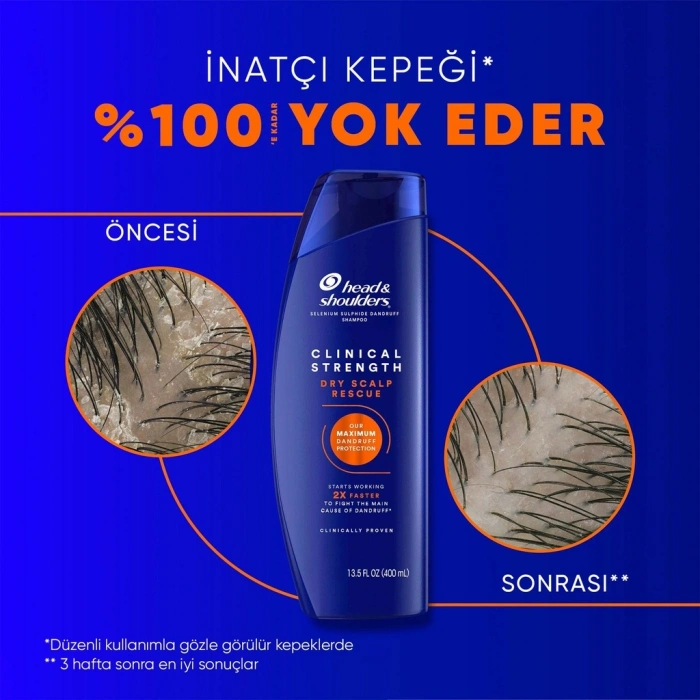 Head & Shoulders Clinical Strength Dry Scalp Rescue Kuru Saç Derisine Özel Şampuan 400 ml