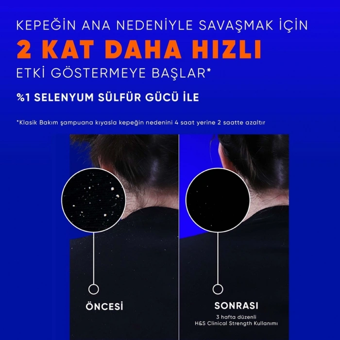 Head & Shoulders Clinical Strength Dry Scalp Rescue Kuru Saç Derisine Özel Şampuan 400 ml